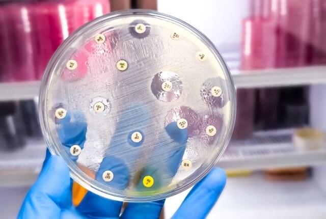 Microscope slide in a laboratory