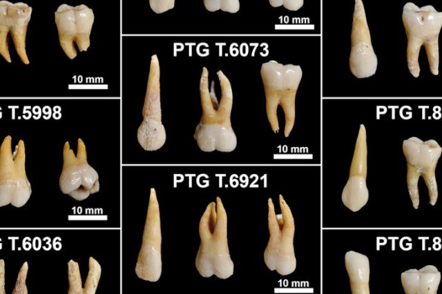Teeth recovered from the archaeological site
