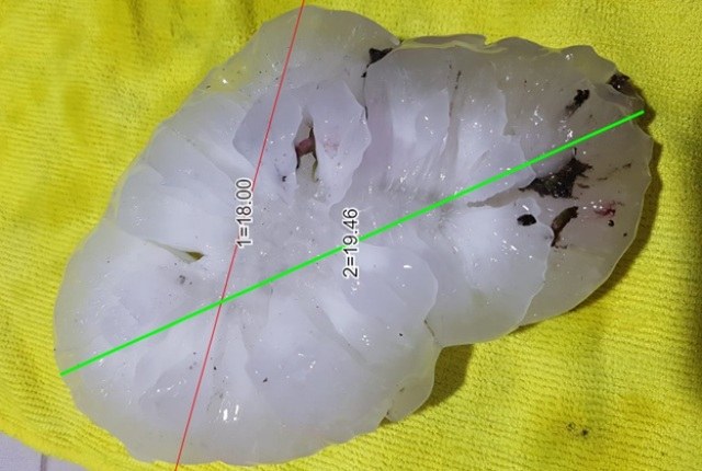 Hailstone