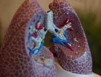lung ventilators lung ventilators