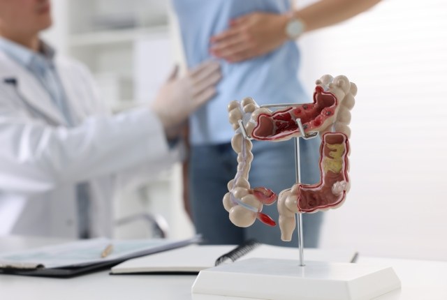Modello anatomico del colon e dell’intestino