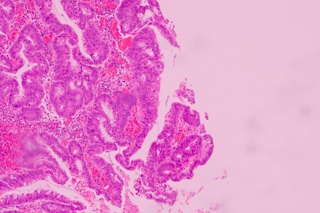 Una molecola osservata al microscopio
