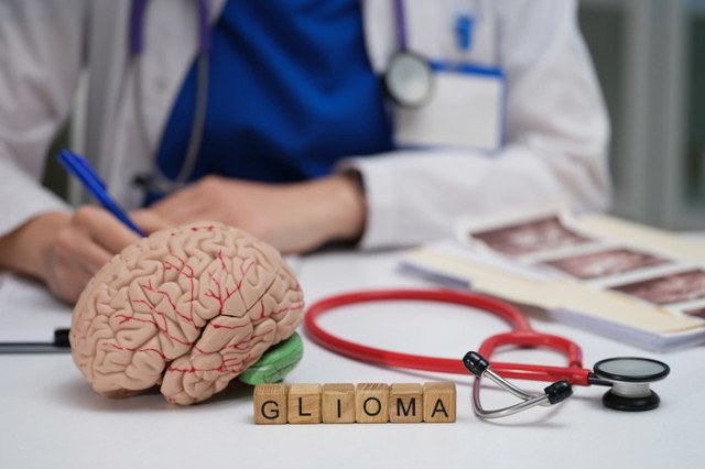 Scena medica con un modello di cervello, un medico che prende appunti, strumenti clinici, la scritta “GLIOMA” e alcune scansioni cerebrali