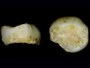 Dente da latte di 13.000 anni