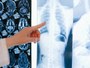 Radiografia